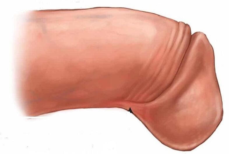 hoe de eikel te vergroten